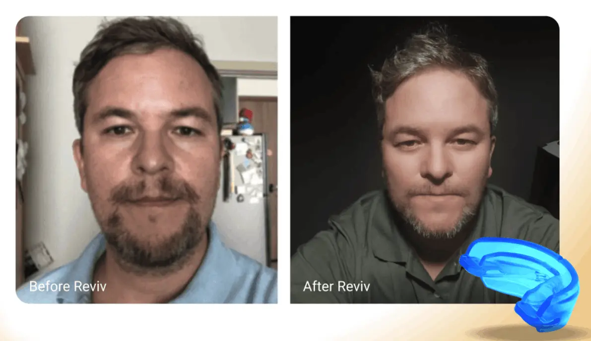 Ikaria Lean Belly Juice how does reviv mouth guard works